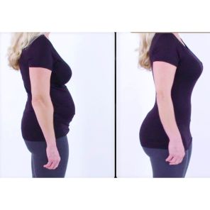 Velform Cross Compression - bielizna wyszczuplająca 1+1